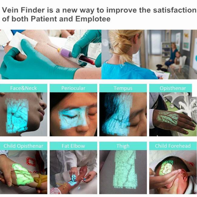 Vein finder portable